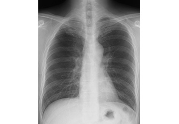 健診時 胸部に異常がみられた方へ 健康サポートについて 医療法人社団慶友会 吉田病院 健康サポート室