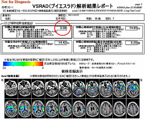 VSRAD解析結果レポート